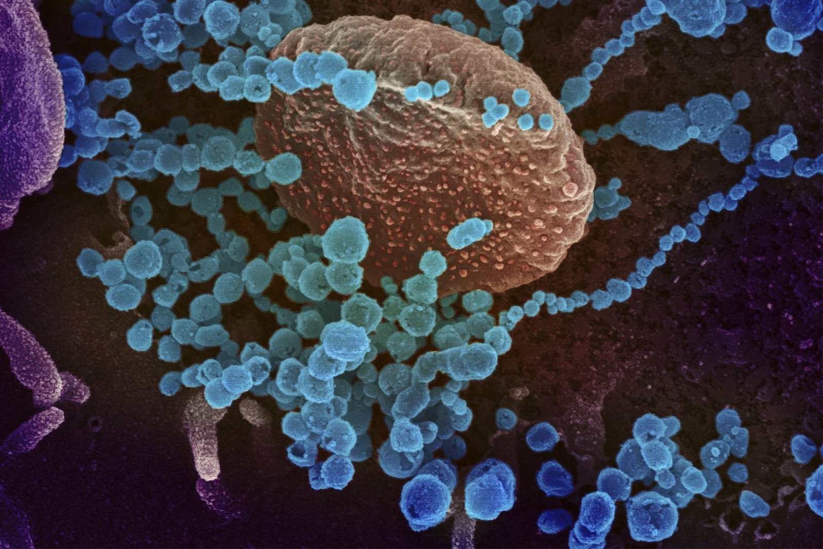 ¿El coronavirus fue creado en laboratorio de forma intencional? Esto dice la ciencia