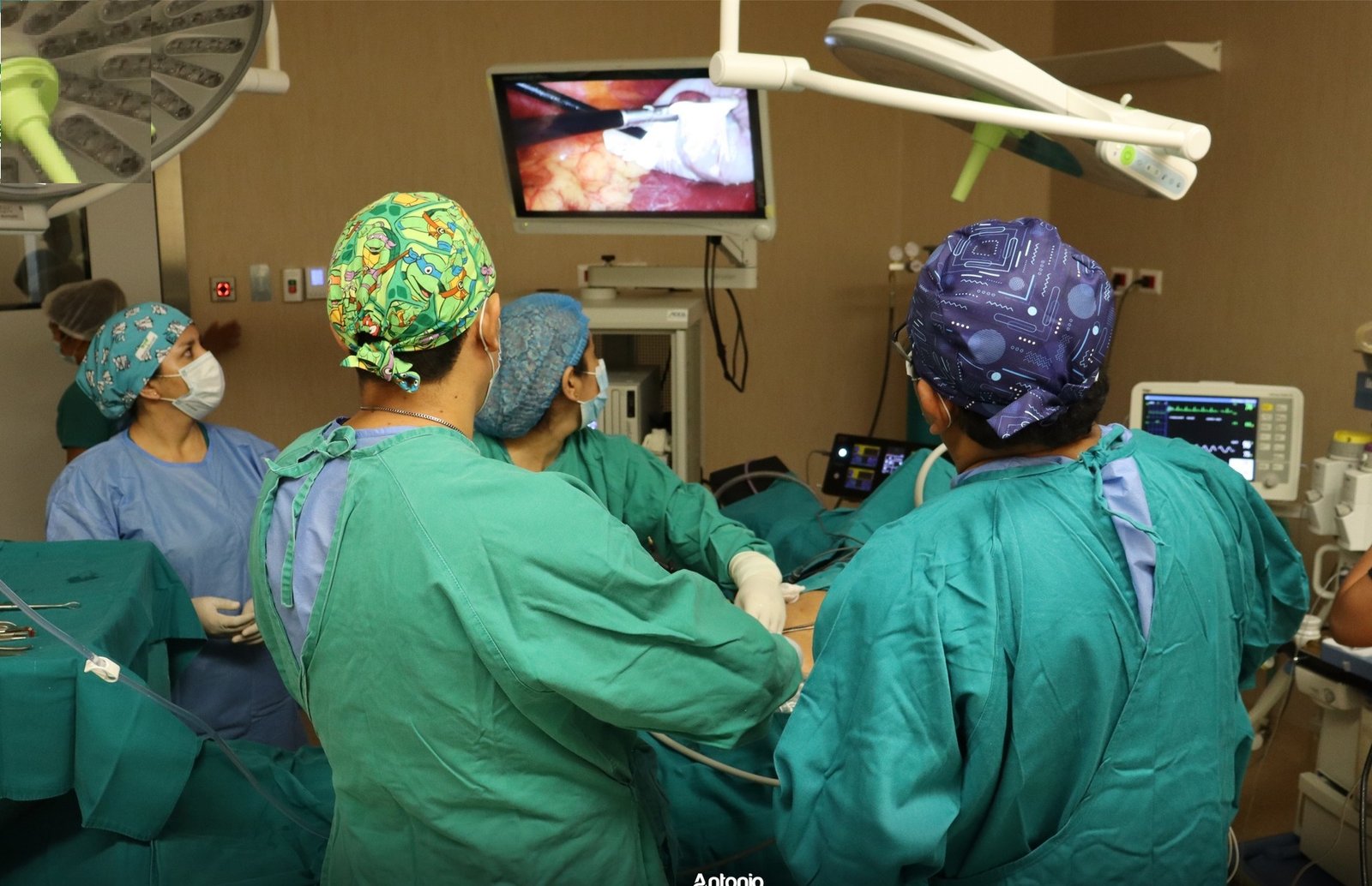 Hospital Hermilio Valdizán ya atendió a 84 pacientes con campaña de desembalse quirúrgico