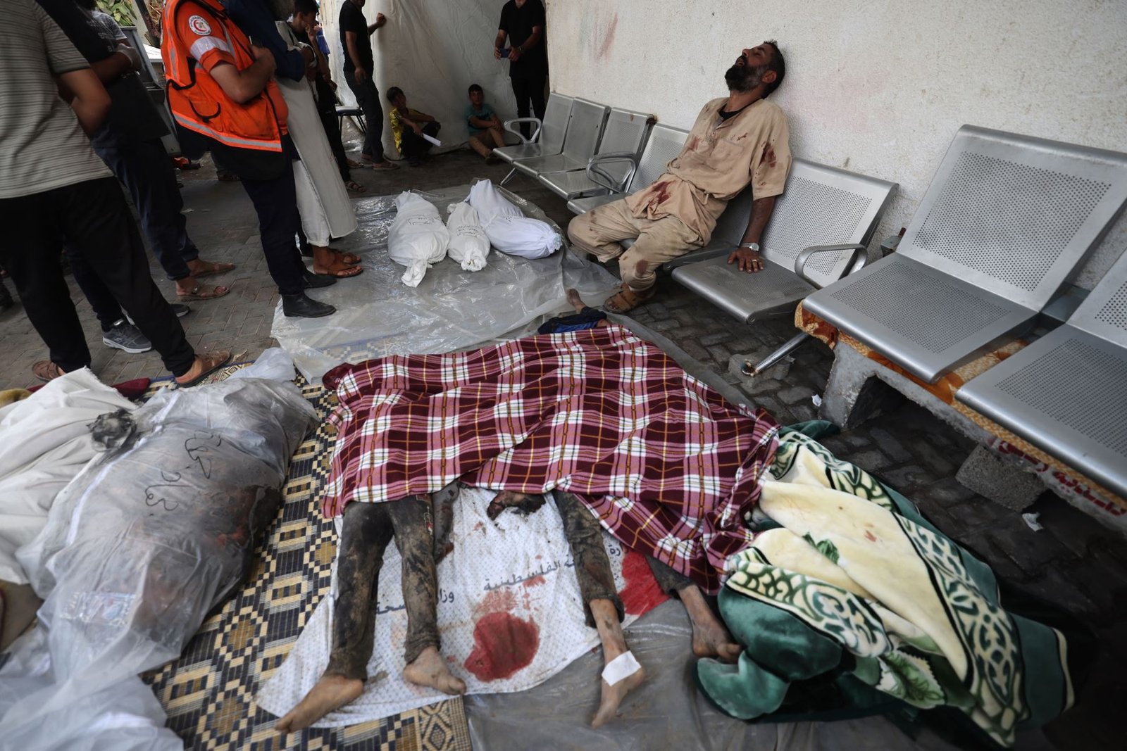La ONU describe las Urgencias del principal hospital de Gaza como “un baño de sangre”
