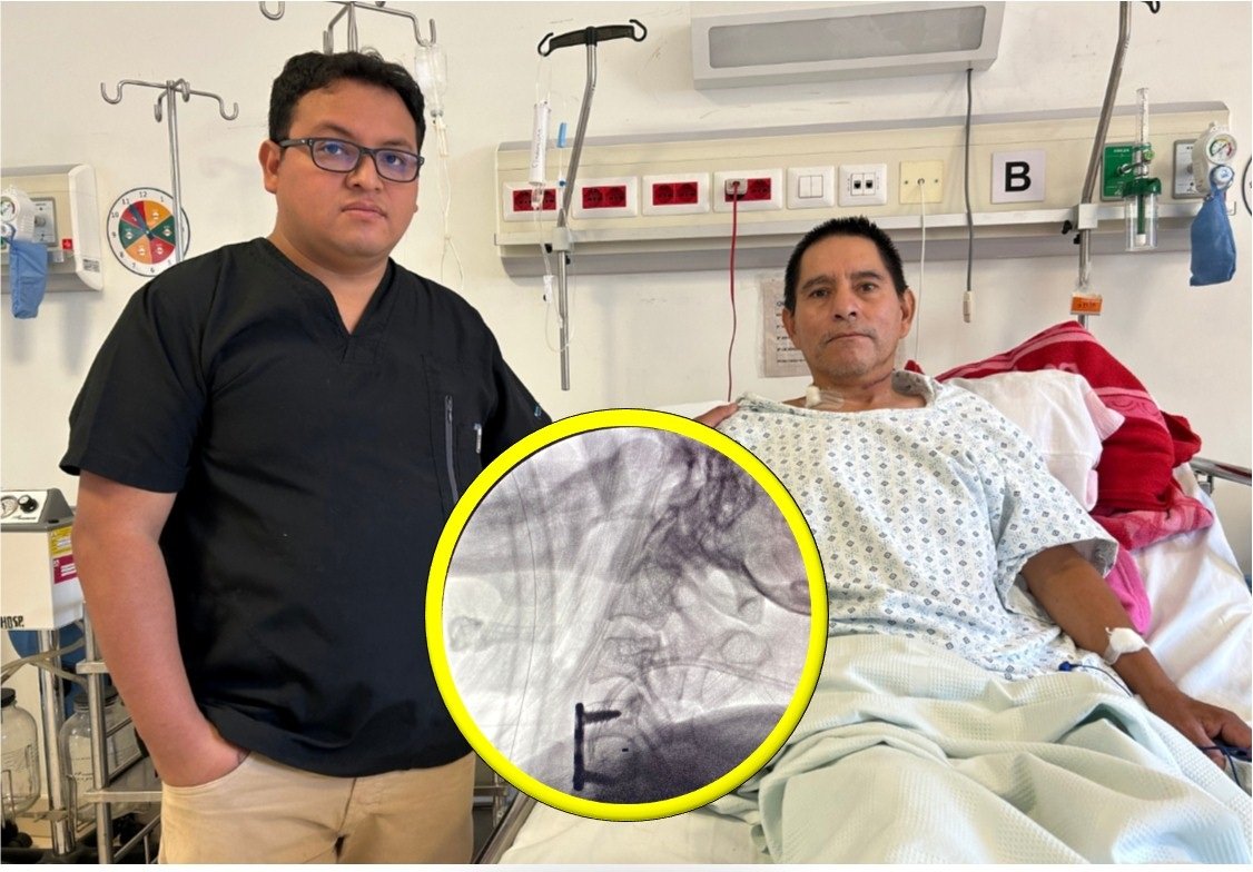 Médicos del Hospital Hermilio Valdizán operaron con éxito a paciente que se fracturó la columna